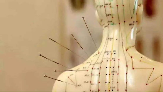 从边缘到主流：中医针灸的国际化突围