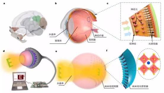 技术突破：从“仿生眼”到“仿生视网膜”的进化